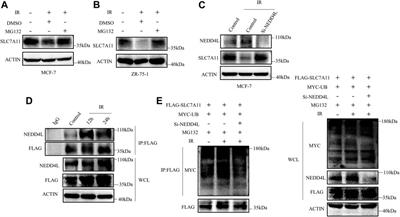 The Dual Regulation Effects of ESR1/NEDD4L on SLC7A11 in Breast Cancer Under Ionizing Radiation